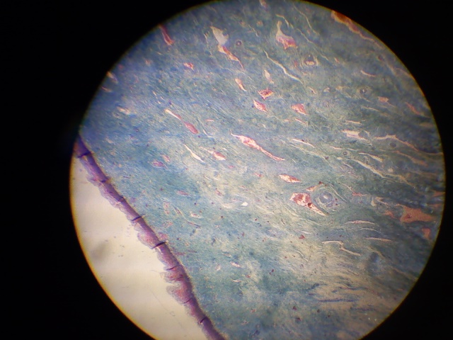 Cervix uteri2.jpg
