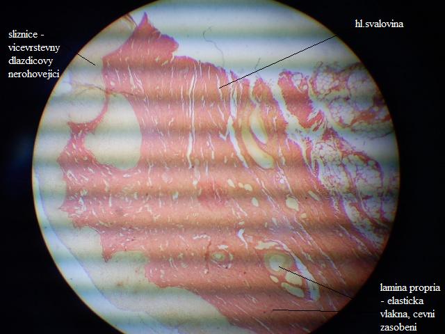 Vagina1 -a.jpg