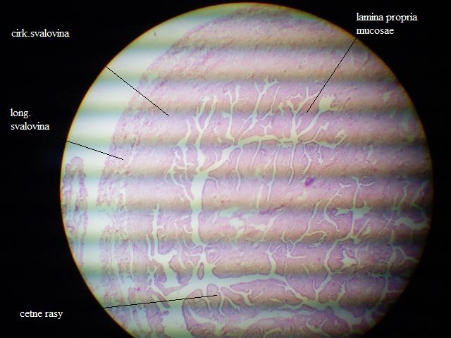 Tuba uterina2 -a.jpg