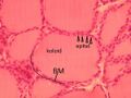 Glandula thyroidea 1
