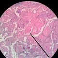 Glandula thyroidea 4