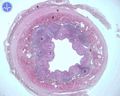 Appendix vermiformis 2