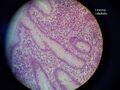Appendix vermiformis 1