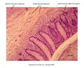 Appendix vermiformis 3