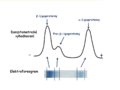 Obr. 7 Elektroforéza lipoproteinů – normální nález