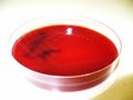Neisseria pharyngis, krevní agar