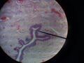 Pars spongiosa urethrae 1