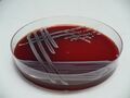 Staphylococcus epidermidis, krevní agar