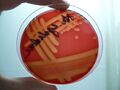 detail hemolýzy Streptococcus agalatiae na KA