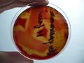 Kultivace Streptococcus pneumoniae na krevním agaru, M-fáze, detail hemolýzy