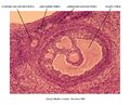 Jednotlivá stádia vývoje folikulů
