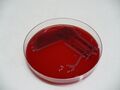 Yersinia enterocolitica, krevní agar