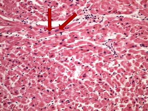 Z1-1 HE (myocardium) HE (myokard) 20x oznaceno.jpg