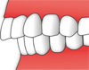 Zuby - opsidodoncie.png