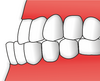 Zuby - prognatodoncie.png