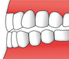 Zuby -labidodoncie.png