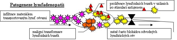 Patogeneze lymfadenopatii.jpg