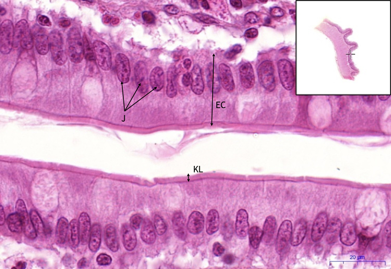 Tenk St evo Small Intestine HE WikiSkripta tenk-st-evo-small-intestine-he-wikiskripta
