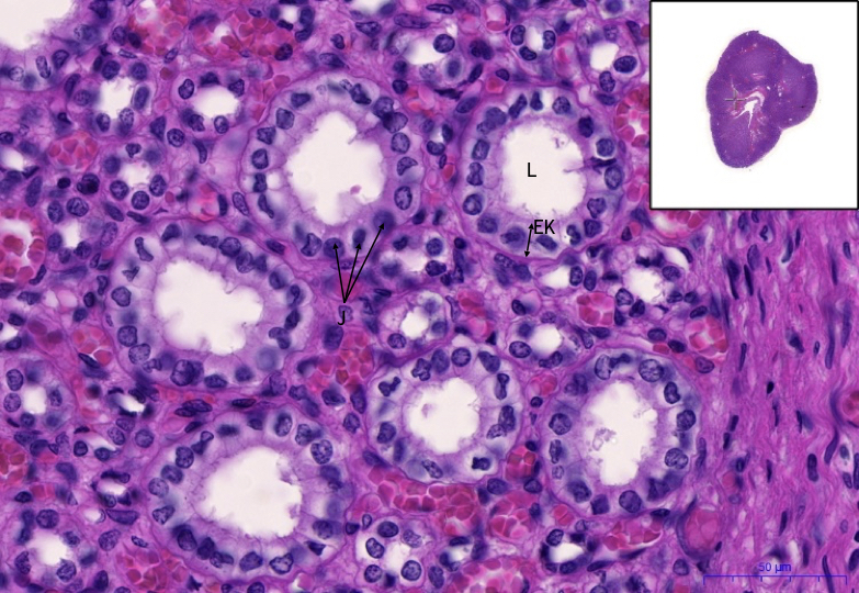Ledvina/ Kidney – HE, 86,8x