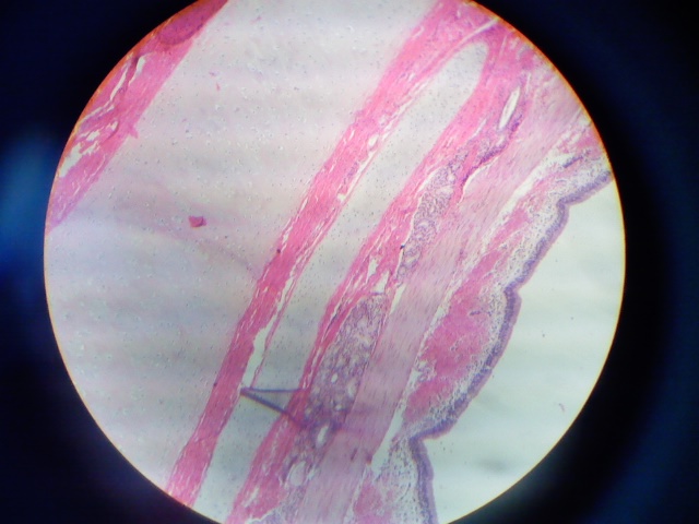 Trachea2.jpg