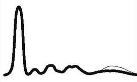 ELFO hypogamaglobulinemie.jpg