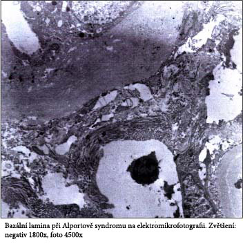 Electron photography of the basement membrane of the glomerulus