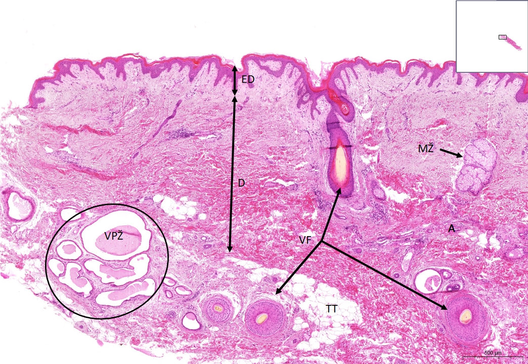 Axilla HE WikiSkripta