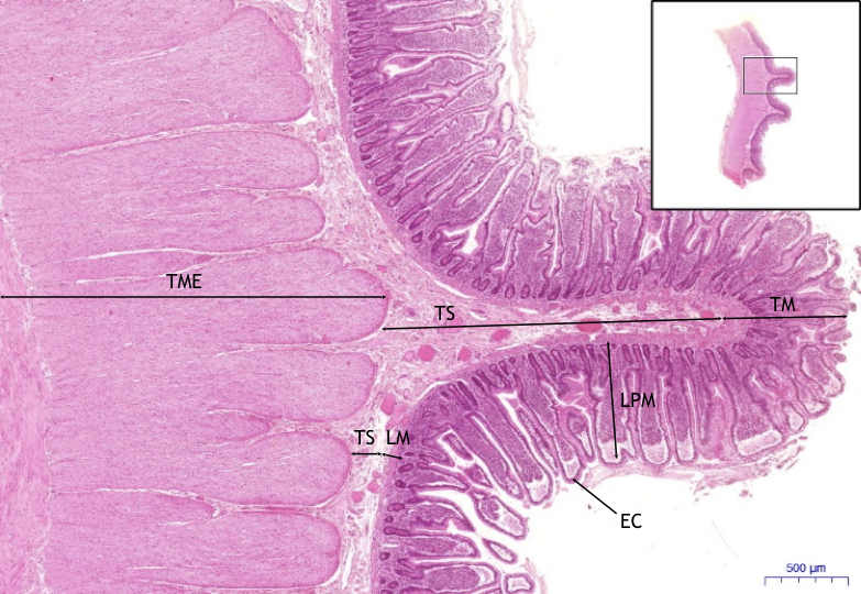 Tenk St evo Small Intestine HE WikiSkripta tenk-st-evo-small-intestine-he-wikiskripta