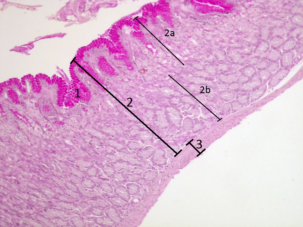 Žaludek fundus 2.jpg