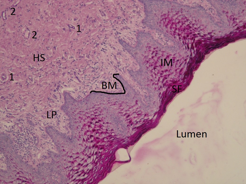 Vagina (SFLT) – WikiSkripta