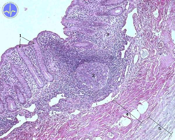 Appendix (SFLT) – WikiSkripta