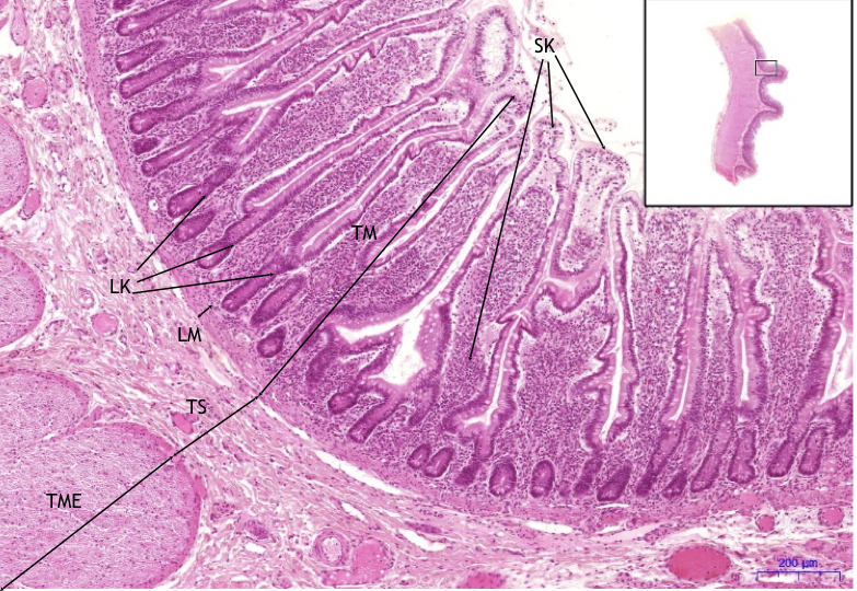 Tenk St evo Small Intestine HE WikiSkripta tenk-st-evo-small-intestine-he-wikiskripta