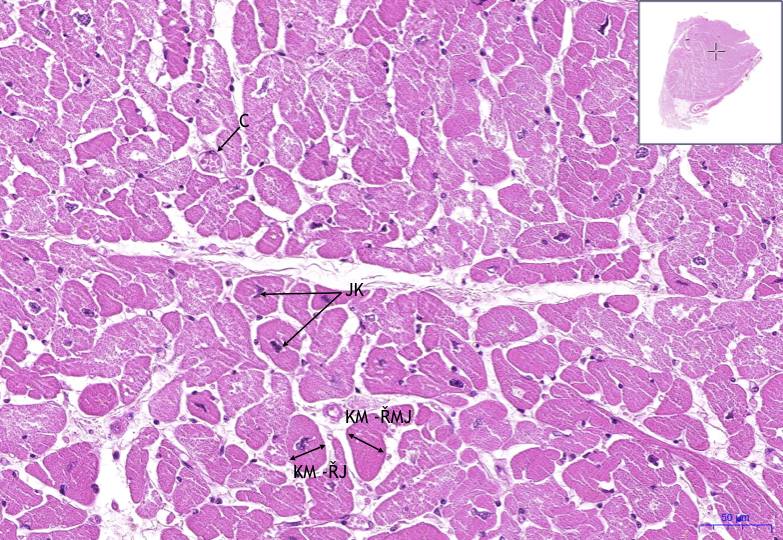 Srdeční sval / Cardiac muscle - HE – WikiSkripta
