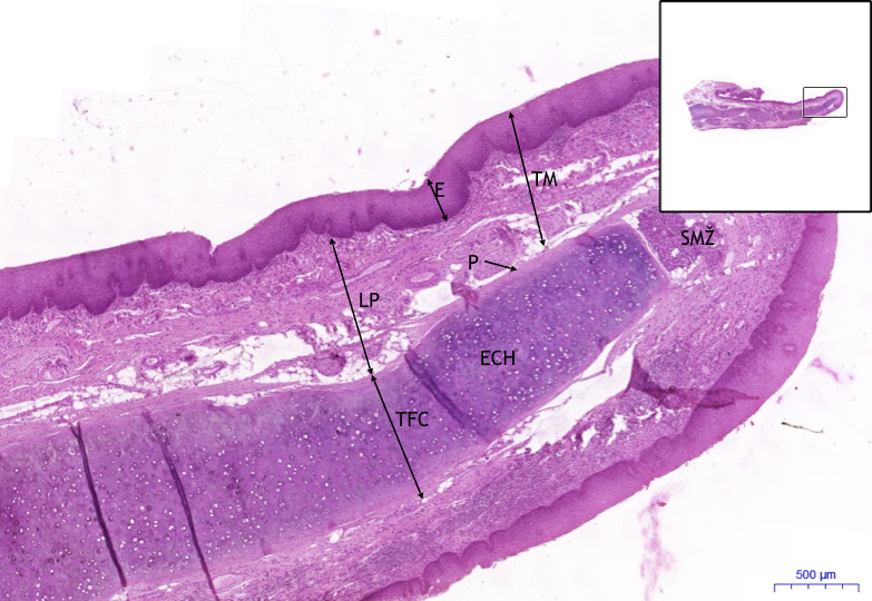 Epiglottis, HE 2x