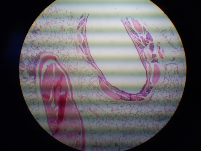 Plíce dospeleho1.jpg