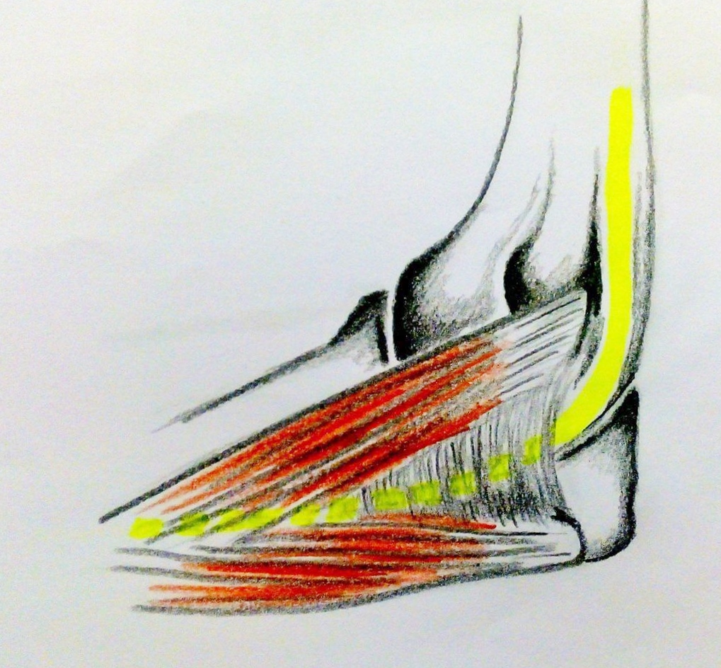Průchod n. ulnaris v canalis cubitalis