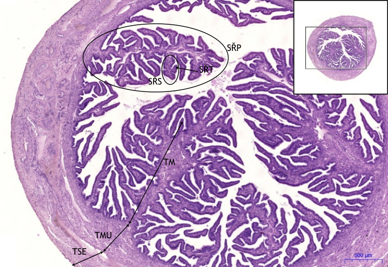 Tuba uterina (ampulla) HE WikiSkripta