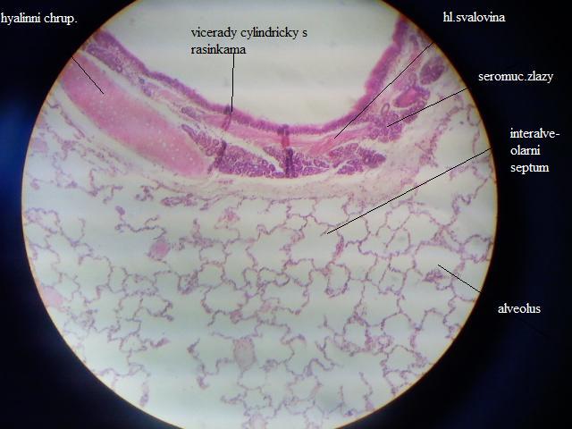 Bronchus segmentalis (histologický preparát) – WikiSkripta
