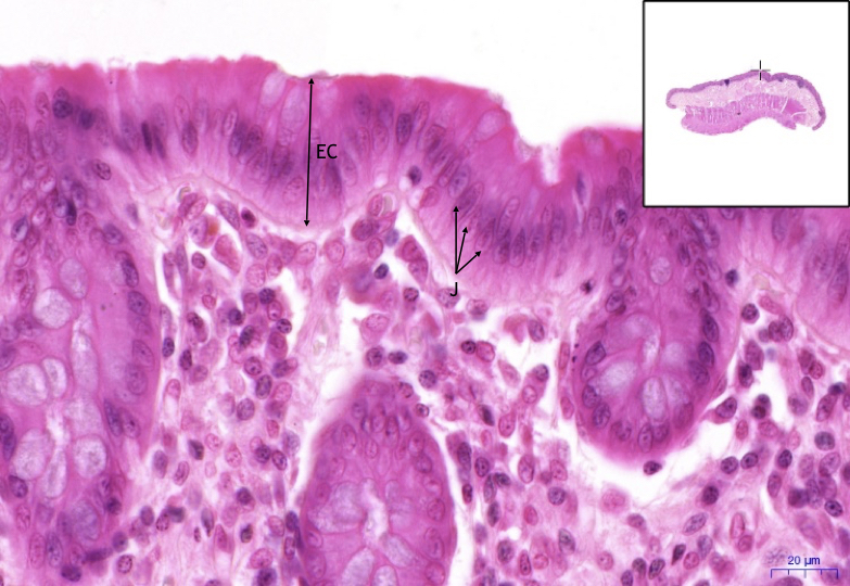 Colon – HE, 40x