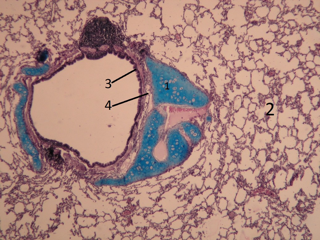 Bronchus_6.jpg