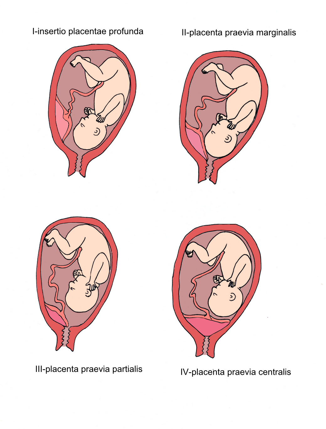 a placenta látási foka)