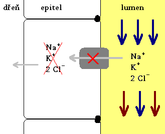 Schéma poruchy iontového přenosu u Bartterova syndromu