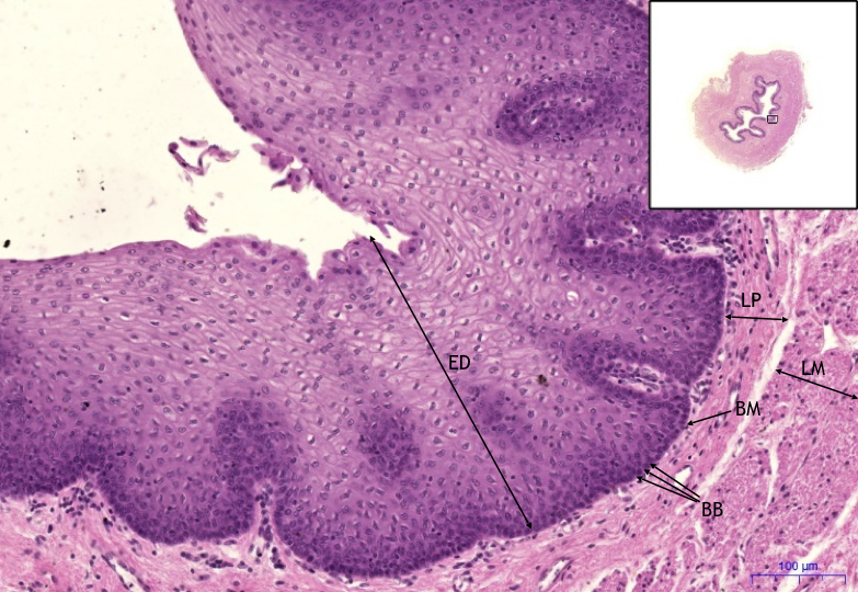 Jícen- Esofagus – HE, 11,2x.jpg