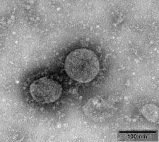 Elektronmikroskopická fotografie kmene 02 koronaviru SARS-CoV-2. Převzato z [1]