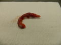 Appendix vermiformis