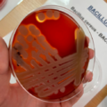 Bacillus cereus, krevní agar