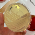 Bacillus cereus, MH agar, Müllerův-Hintonův agar