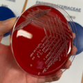 Citrobacter koseri, krevní agar