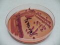 Citrobacter freundii, deoxycholát-citrátový agar, detail