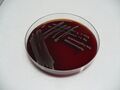 Citrobacter freundii, krevní agar, detail